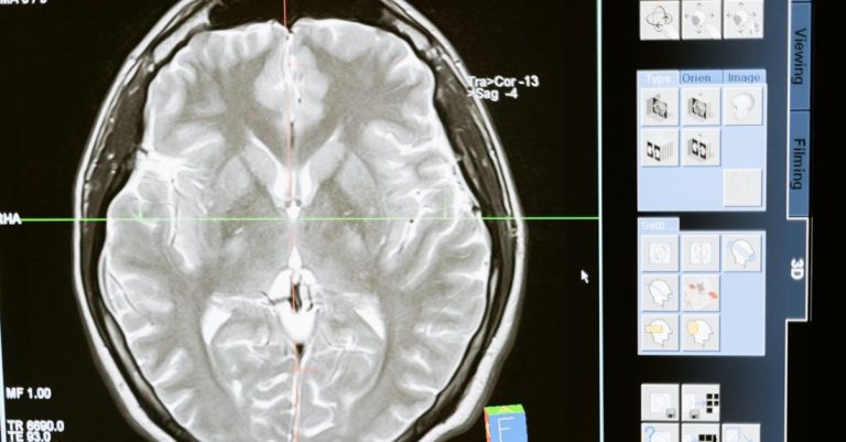 Scientific Technology - Free stock photo of analysis, anatomy, brain