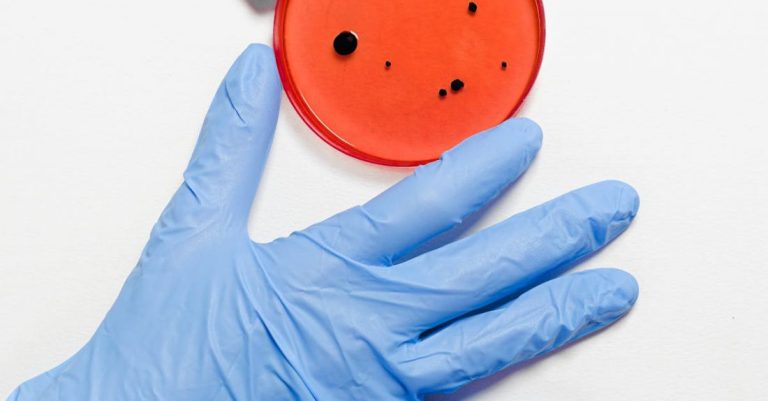 Microbiology - Person in Blue Gloves Holding Petri Dish